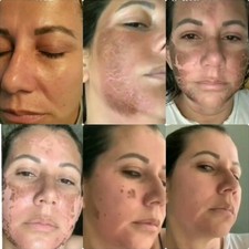 MONNASKIN Algae Pell (peeling