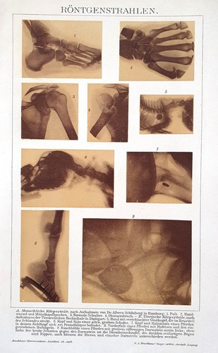 Antica stampa 1898 radiografie - stampa,