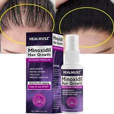 Minoxidil 2% Trattamento