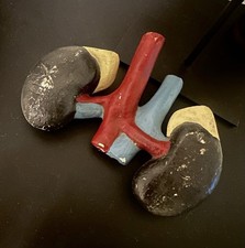 Gesso Anatomico Reni