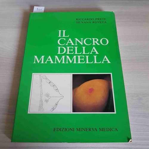 Cancro della mammella - il,