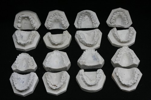 Teeth plaster casts sets - plaster, x8