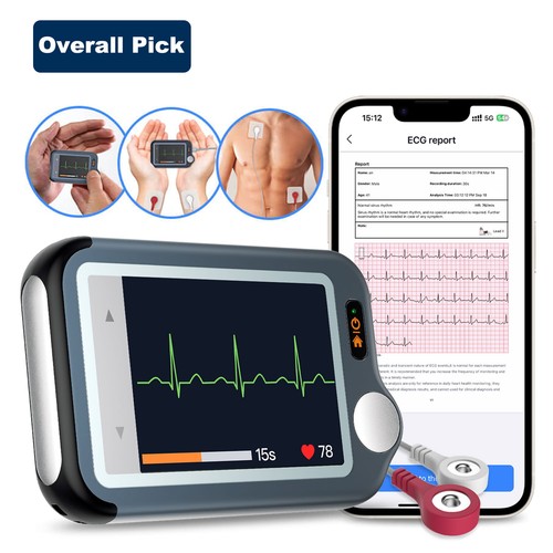 Checkme bluetooth ecg - checkme, ex