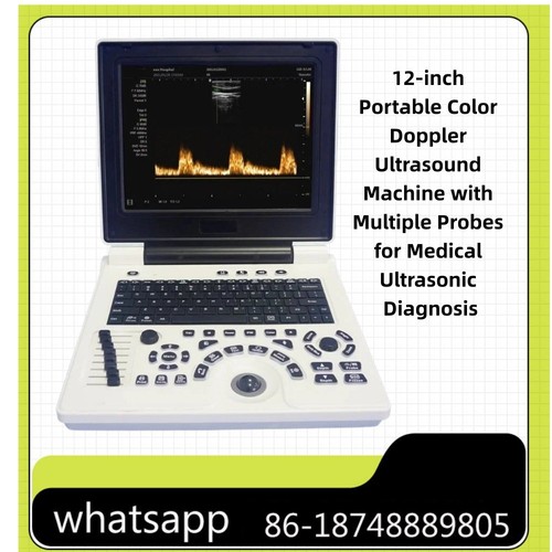 Laptop ultrasound color - ultrasound,