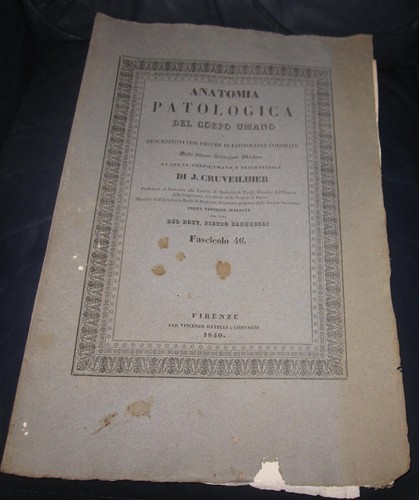 1845 fasc cruveilhier jean - 1845, fasc.