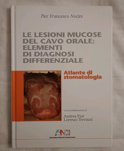 Lesioni mucose del cavo - le,