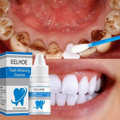 Essenza sbiancante denti - essenza,