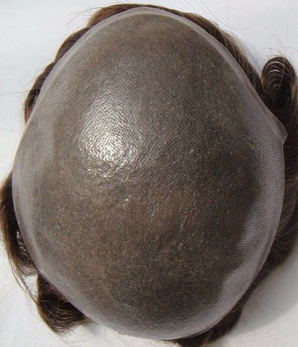 Sistema ricambio capelli - sistema,