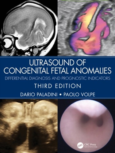 Ultrasound congenital fetal - ultrasound,