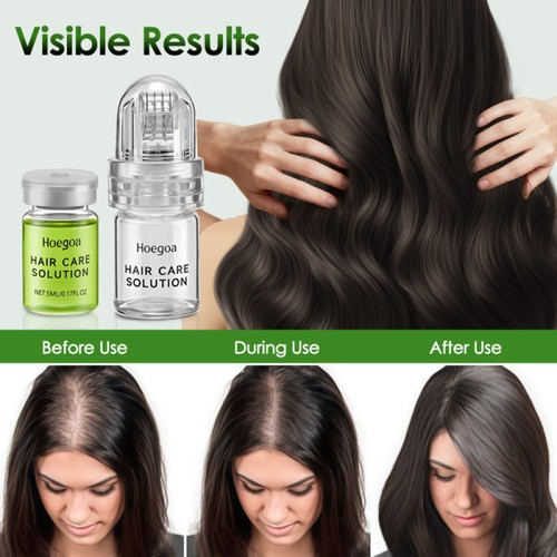 Advanced microneedle sistema - advanced,