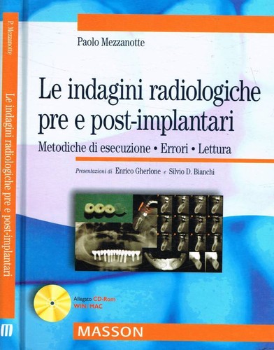 Indagini radiologiche pre - indagini,