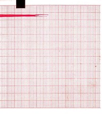 Ecg paper 90mmx70mmx400sheets - ecg,