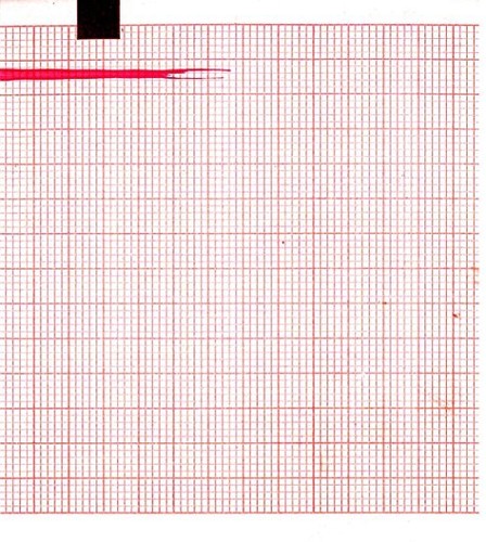 Carta ecg 90mmx70mmx400fogli - carta,