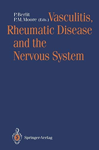 Vasculitis rheumatic - vasculitis,,
