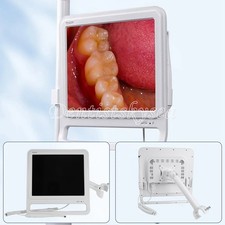 Telecamera intraorale dentale
