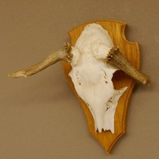 Cervo Anormale Doppio Frattura