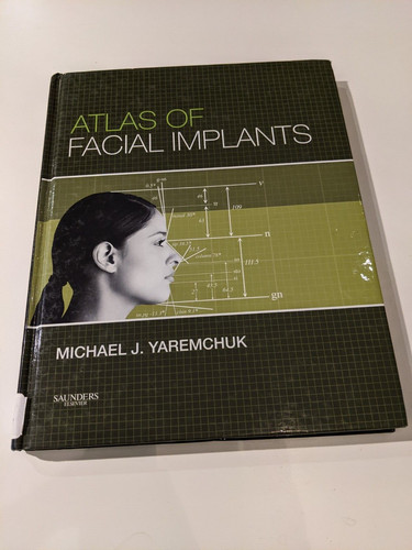 Atlas facial implants - facial,
