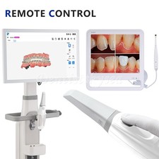 Scanner intraorale immagini 3D