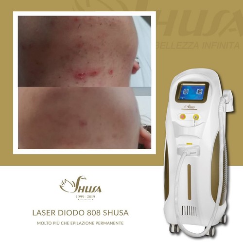 Laser diodo 808nm - laser,