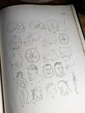 1865 the malformations - 1865, of