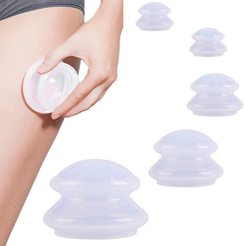 Acupoint set coppettazione - ,