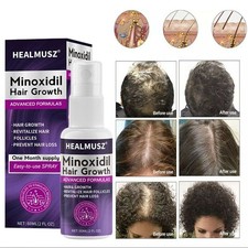 Minoxidil 2% Siero Crescita