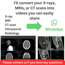 If You Using Anagel 250ml Gel