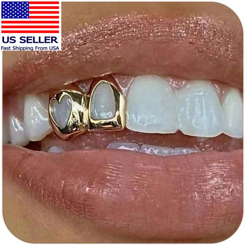 Griglie oro per tuoi denti - griglie, i