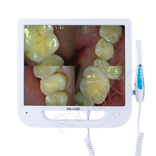 Telecamera intraorale dentale