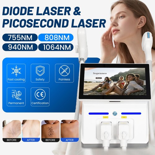 Depilazione laser diodi in - laser, 2