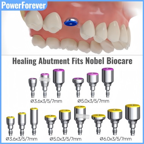 Dental nob healing - dental,