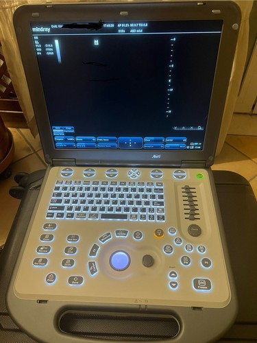 Ecocardiografo portatile