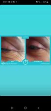 Jeunesse Instantly Ageless 10 fiale Offerta crema Lifting istantaneo occhi