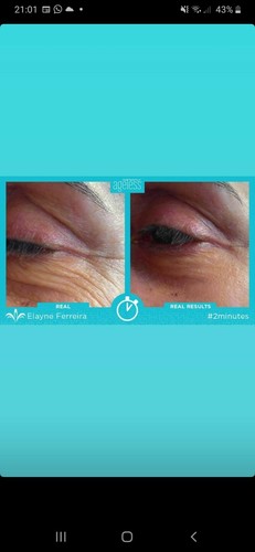 Jeunesse instantly ageless - instantly,