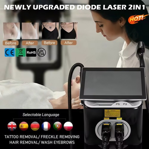 Macchina per depilazione laser
