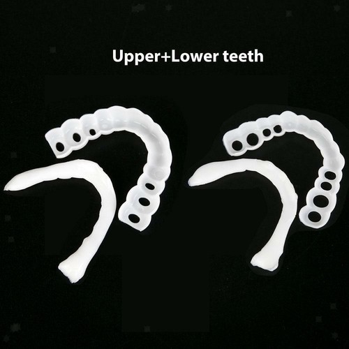Faccette dental superiori - faccette,