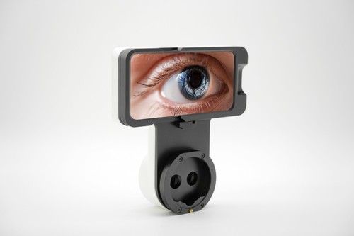 Aio imaging optic system - aio,