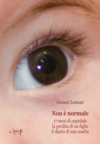 Non normale mesi di - normale.,