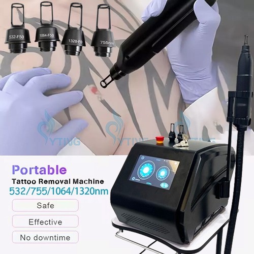 Macchina peeling laser - , q