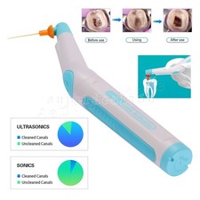 Dentista Endodonzia Endo Ultra