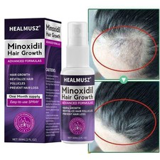Minoxidil 2% Trattamento
