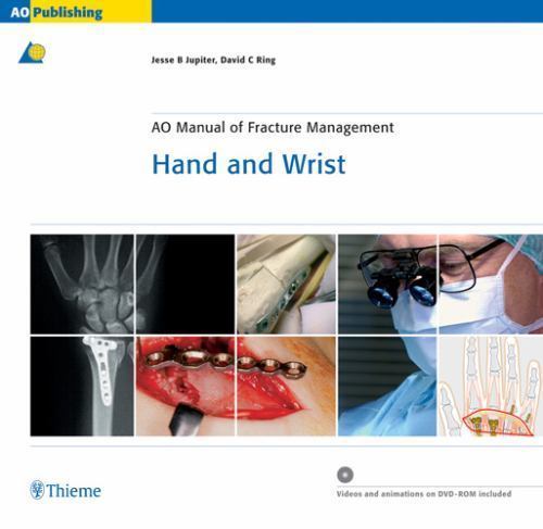 Manual fracture - ao,