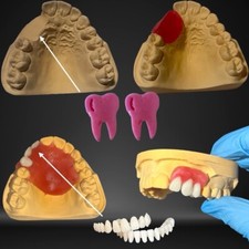 Kit Di Riparazione Modello
