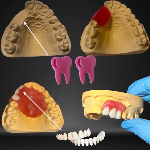 Kit riparazione modello - riparazione,