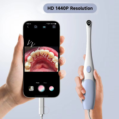 Telecamera intraorale dentale