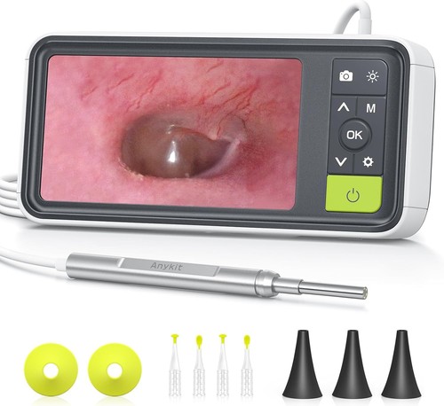 Otoscopio mm con - mm,