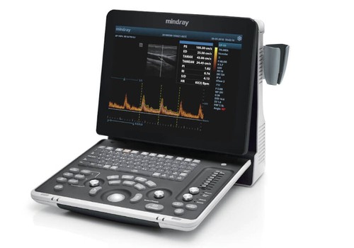 New mindray 50 ultrasound - mindray, dp-50