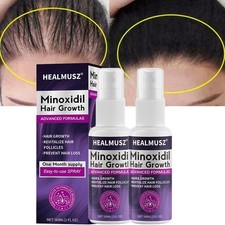 Minoxidil 2% Trattamento