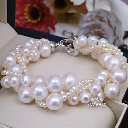 Splendido bracciale - splendido,