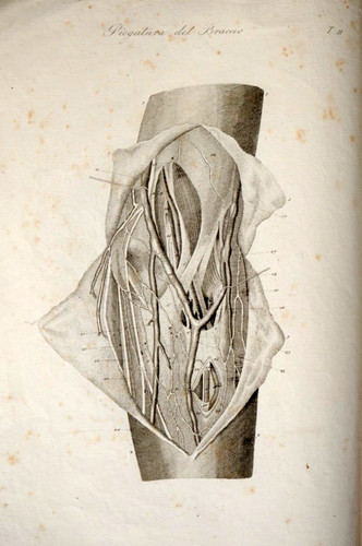 Velpeau atlante anatomia - velpeau,